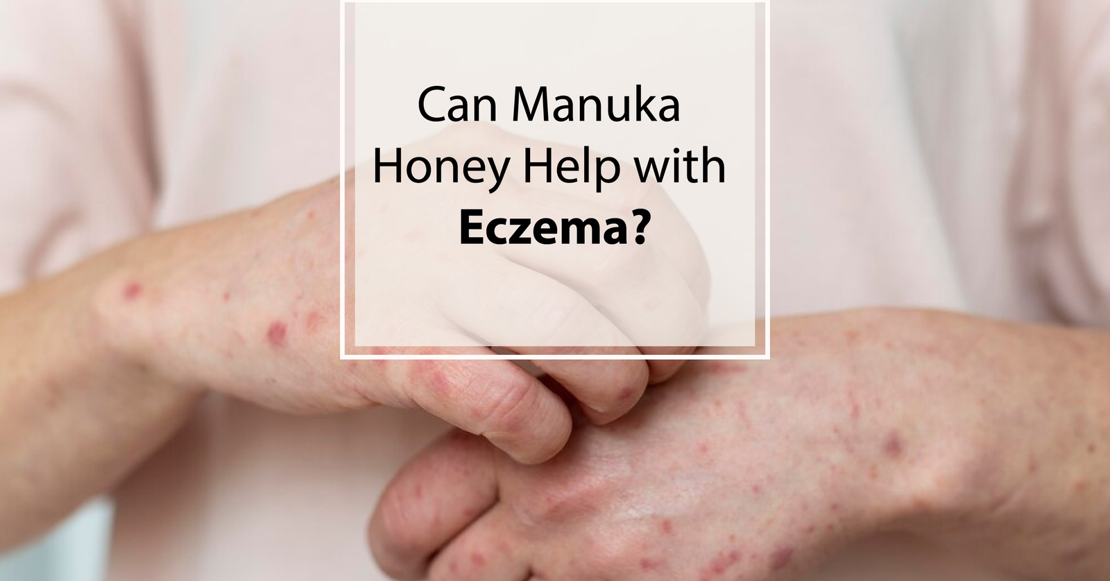 is manuka honey good for eczema