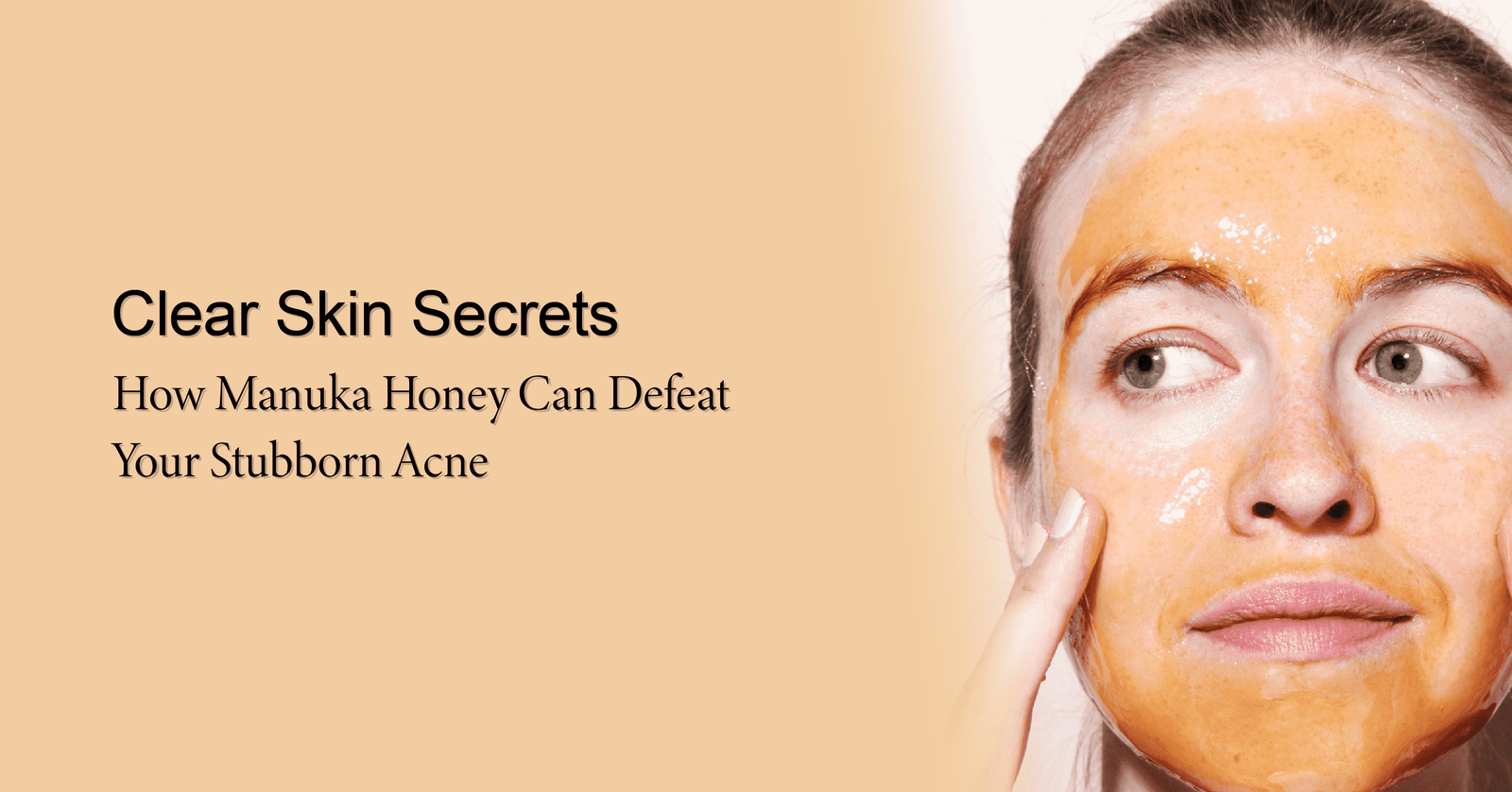 manuka honey for acne